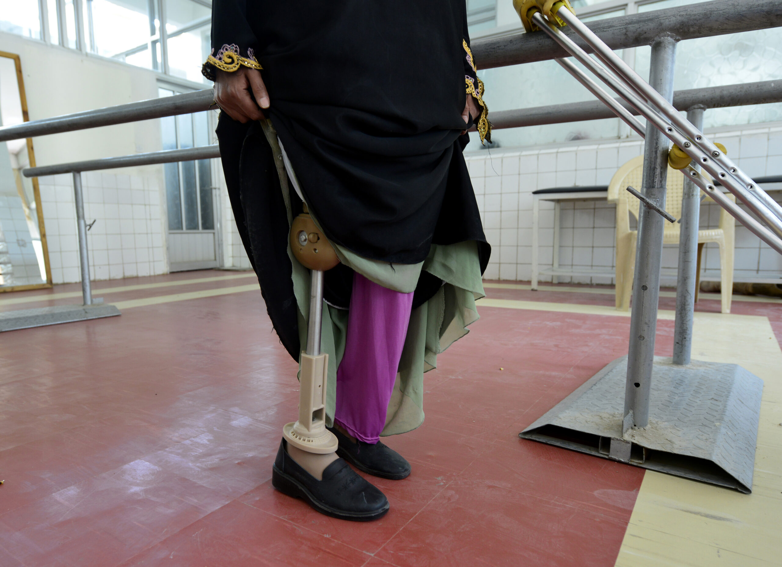 A woman tries out a prosthetic limb at a rehabilitation center in Sana'a, Yemen, in April. According to government statistics, Yemen has cleared 524,000 landmines and explosive shells over the last 10 years. Pope Francis is urging international action to rid the world of landmines, which, he said, prolong war and nurture fear. (CNS photo/Yahya Arhab, EPA)